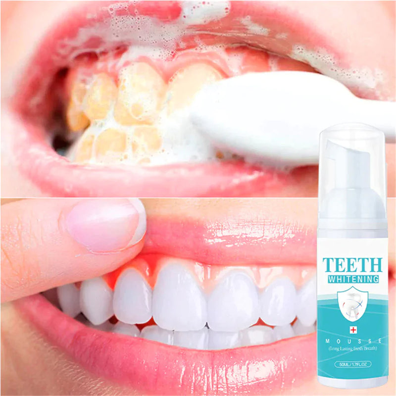 White Plus - Clareador Dental Instantâneo